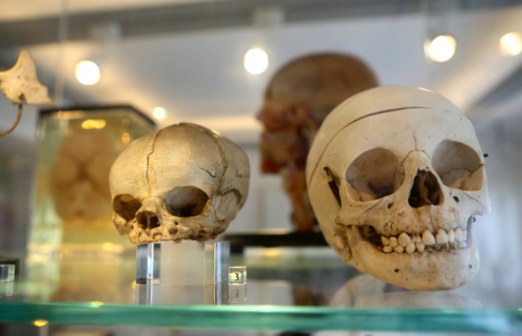Crânios humanos numa exposição sobre história da anatomia, em 2016, em Berlim, Alemanha ADAM BERRY/GETTY IMAGES